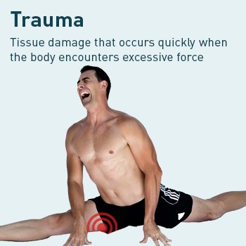 diagram of leg trauma pain